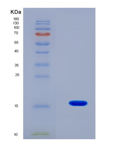SDS-PAGE analysis of Human PABPC1L (Polyadenylate-Binding Protein 1-Like) - Recombinant Protein, CAT# BLT-08178P, showing >90% purity under 15% SDS-PAGE (Reduced)Human PABPC1L (Polyadenylate-Binding Protein 1-Like) - Recombinant Protein