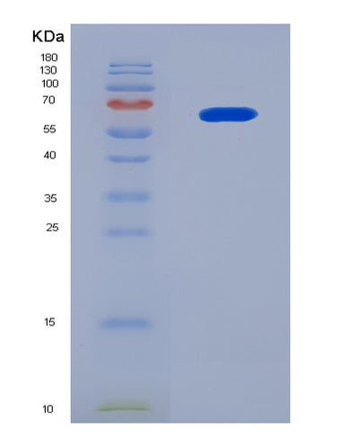 SDS-PAGE analysis of Mouse Gck (Hexokinase-4) - Recombinant Protein, CAT# BLT-08180P, showing >90% purity under 15% SDS-PAGE (Reduced)Mouse Gck (Hexokinase-4) - Recombinant Protein