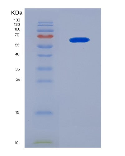 SDS-PAGE analysis of Mouse Gck (Hexokinase-4) - Recombinant Protein, CATMouse Gck (Hexokinase-4) - Recombinant Protein