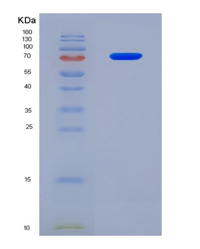 SDS-PAGE analysis of Human TUBB (Tubulin Beta Chain) - Recombinant Protein, CAT# BLT-08181P, showing >90% purity under 15% SDS-PAGE (Reduced)Human TUBB (Tubulin Beta Chain) - Recombinant Protein