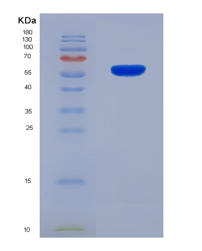 SDS-PAGE analysis of Human MMP1 (Interstitial Collagenase) - Recombinant Protein, CATHuman MMP1 (Interstitial Collagenase) - Recombinant Protein