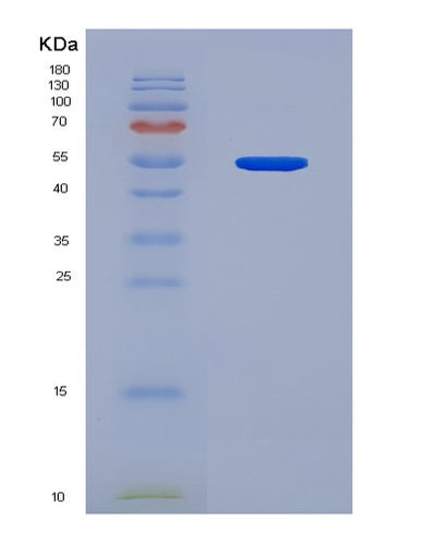 SDS-PAGE analysis of Mouse Dnmt1 (Dna (Cytosine-5)-Methyltransferase 1) - Recombinant Protein, CAT# BLT-08185P, showing >90% purity under 15% SDS-PAGE (Reduced)Mouse Dnmt1 (Dna (Cytosine-5)-Methyltransferase 1) - Recombinant Protein