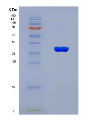 SDS-PAGE analysis of Human SPARC (Sparc) - Recombinant Protein, CAT# BLT-08186P, showing >90% purity under 15% SDS-PAGE (Reduced)Human SPARC (Sparc) - Recombinant Protein