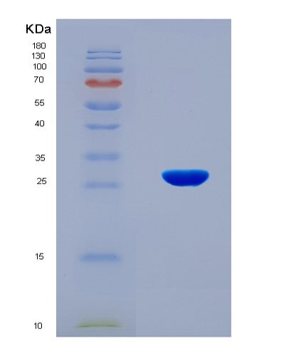 SDS-PAGE analysis of Human FDX1 (Adrenodoxin, Mitochondrial) - Recombinant Protein, CATHuman FDX1 (Adrenodoxin, Mitochondrial) - Recombinant Protein