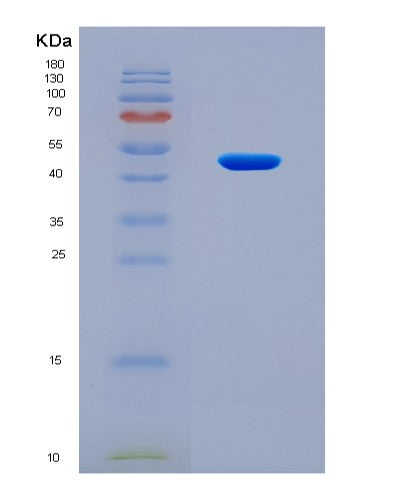 SDS-PAGE analysis of Human ULK1 (Serine/Threonine-Protein Kinase Ulk1) - Recombinant Protein, CATHuman ULK1 (Serine/Threonine-Protein Kinase Ulk1) - Recombinant Protein