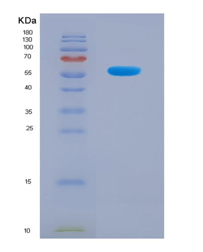 SDS-PAGE analysis of Mouse Ctsg (Cathepsin G) - Recombinant Protein, CAT# BLT-08190P, showing >90% purity under 15% SDS-PAGE (Reduced)Mouse Ctsg (Cathepsin G) - Recombinant Protein