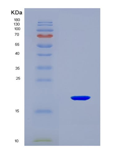 SDS-PAGE analysis of Mouse Sod1 (Superoxide Dismutase [Cu-Zn]) - Recombinant Protein, CAT# BLT-08193P, showing >90% purity under 15% SDS-PAGE (Reduced)Mouse Sod1 (Superoxide Dismutase [Cu-Zn]) - Recombinant Protein