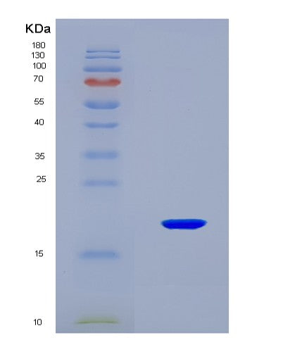 SDS-PAGE analysis of Mouse Sod1 (Superoxide Dismutase [Cu-Zn]) - Recombinant Protein, CATMouse Sod1 (Superoxide Dismutase [Cu-Zn]) - Recombinant Protein