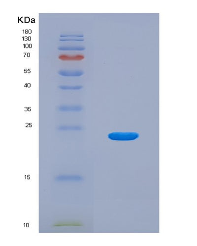 SDS-PAGE analysis of Mouse Calr (Calreticulin) - Recombinant Protein, CAT# BLT-08194P, showing >90% purity under 15% SDS-PAGE (Reduced)Mouse Calr (Calreticulin) - Recombinant Protein