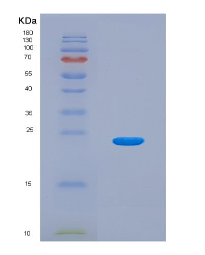 SDS-PAGE analysis of Mouse Calr (Calreticulin) - Recombinant Protein, CATMouse Calr (Calreticulin) - Recombinant Protein