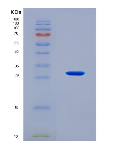 SDS-PAGE analysis of Human CLEC9A (C-Type Lectin Domain Family 9 Member A) - Recombinant Protein, CAT# BLT-08196P, showing >90% purity under 15% SDS-PAGE (Reduced)Human CLEC9A (C-Type Lectin Domain Family 9 Member A) - Recombinant Protein