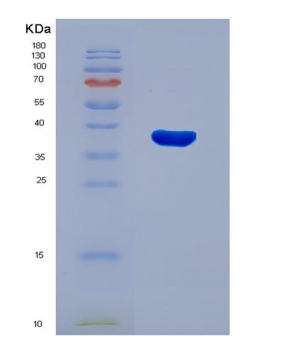 SDS-PAGE analysis of Human MTHFD2 (Bifunctional Methylenetetrahydrofolate Dehydrogenase/Cyclohydrolase, Mitochondrial) - Recombinant Protein, CAT# BLT-08197P, showing >90% purity under 15% SDS-PAGE (Reduced)Human MTHFD2 (Bifunctional Methylenetetrahydrofolate Dehydrogenase/Cyclohydrolase, Mitochondrial) - Recombinant Protein