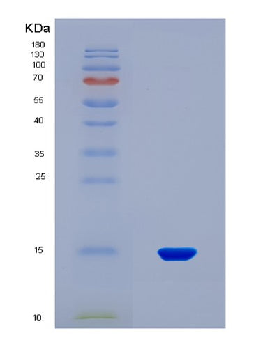 SDS-PAGE analysis of Human INHBA (Inhibin Beta A Chain) - Recombinant Protein, CAT# BLT-08198P, showing >90% purity under 15% SDS-PAGE (Reduced)Human INHBA (Inhibin Beta A Chain) - Recombinant Protein