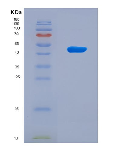 SDS-PAGE analysis of Human AGER (Advanced Glycosylation End Product-Specific Receptor) - Recombinant Protein, CAT# BLT-08200P, showing >90% purity under 15% SDS-PAGE (Reduced)Human AGER (Advanced Glycosylation End Product-Specific Receptor) - Recombinant Protein