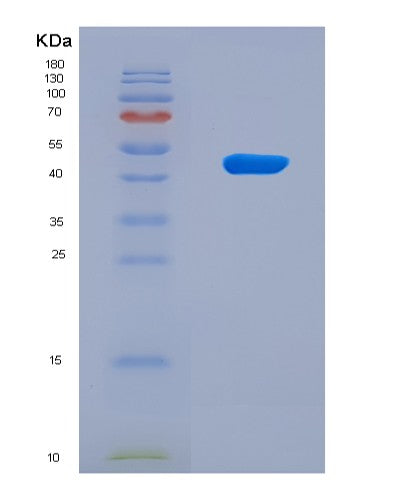 SDS-PAGE analysis of Human AGER (Advanced Glycosylation End Product-Specific Receptor) - Recombinant Protein, CATHuman AGER (Advanced Glycosylation End Product-Specific Receptor) - Recombinant Protein