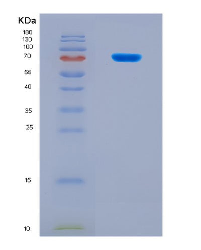 SDS-PAGE analysis of Human PKMYT1 (Membrane-Associated Tyrosine- And Threonine-Specific Cdc2-Inhibitory Kinase) - Recombinant Protein, CAT# BLT-08201P, showing >90% purity under 15% SDS-PAGE (Reduced)Human PKMYT1 (Membrane-Associated Tyrosine- And Threonine-Specific Cdc2-Inhibitory Kinase) - Recombinant Protein