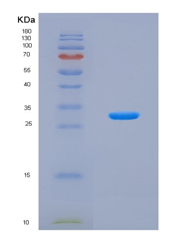 SDS-PAGE analysis of Human GABRA1 (Gamma-Aminobutyric Acid Receptor Subunit Alpha-1) - Recombinant Protein, CATHuman GABRA1 (Gamma-Aminobutyric Acid Receptor Subunit Alpha-1) - Recombinant Protein