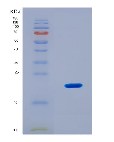 SDS-PAGE analysis of Human Mothers against decapentaplegic homolog 3(SMAD3) - Recombinant Protein, CAT# BLT-08203P, showing >90% purity under 15% SDS-PAGE (Reduced)Human Mothers against decapentaplegic homolog 3(SMAD3) - Recombinant Protein
