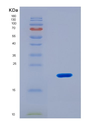 SDS-PAGE analysis of Human Mothers against decapentaplegic homolog 3(SMAD3) - Recombinant Protein, CATHuman Mothers against decapentaplegic homolog 3(SMAD3) - Recombinant Protein