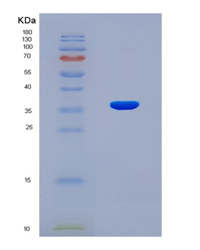 SDS-PAGE analysis of Human TRIM2 (Tripartite Motif-Containing Protein 2) - Recombinant Protein, CAT# BLT-08205P, showing >90% purity under 15% SDS-PAGE (Reduced)Human TRIM2 (Tripartite Motif-Containing Protein 2) - Recombinant Protein