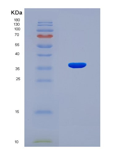 SDS-PAGE analysis of Human TRIM2 (Tripartite Motif-Containing Protein 2) - Recombinant Protein, CATHuman TRIM2 (Tripartite Motif-Containing Protein 2) - Recombinant Protein