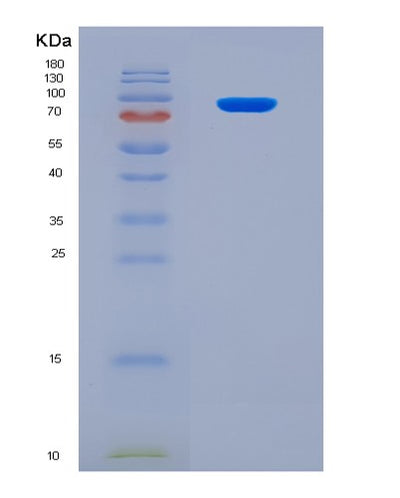SDS-PAGE analysis of Human WEE1 (Wee1-Like Protein Kinase) - Recombinant Protein, CAT# BLT-08206P, showing >90% purity under 15% SDS-PAGE (Reduced)Human WEE1 (Wee1-Like Protein Kinase) - Recombinant Protein