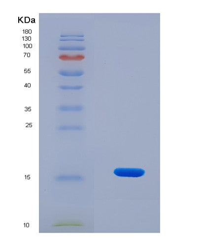 SDS-PAGE analysis of Human HIGD1A (Hig1 Domain Family Member 1A, Mitochondrial) - Recombinant Protein, CATHuman HIGD1A (Hig1 Domain Family Member 1A, Mitochondrial) - Recombinant Protein