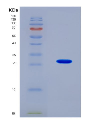 SDS-PAGE analysis of Mouse Ripk2 (Receptor-Interacting Serine/Threonine-Protein Kinase 2) - Recombinant Protein, CAT# BLT-08208P, showing >90% purity under 15% SDS-PAGE (Reduced)Mouse Ripk2 (Receptor-Interacting Serine/Threonine-Protein Kinase 2) - Recombinant Protein
