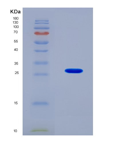 SDS-PAGE analysis of Mouse Ripk2 (Receptor-Interacting Serine/Threonine-Protein Kinase 2) - Recombinant Protein, CATMouse Ripk2 (Receptor-Interacting Serine/Threonine-Protein Kinase 2) - Recombinant Protein
