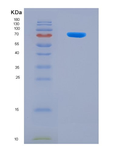 SDS-PAGE analysis of Mouse Gad2 (Glutamate Decarboxylase 2) - Recombinant Protein, CATMouse Gad2 (Glutamate Decarboxylase 2) - Recombinant Protein