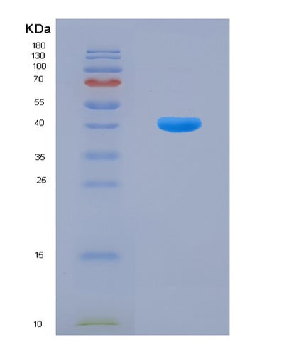 SDS-PAGE analysis of Human OCLN (Occludin) - Recombinant Protein, CAT# BLT-08210P, showing >90% purity under 15% SDS-PAGE (Reduced)Human OCLN (Occludin) - Recombinant Protein
