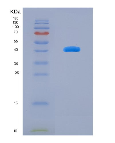 SDS-PAGE analysis of Human B-Lymphocyte Chemoattractant (BLC) - Recombinant Protein, CATHuman B-Lymphocyte Chemoattractant (BLC) - Recombinant Protein
