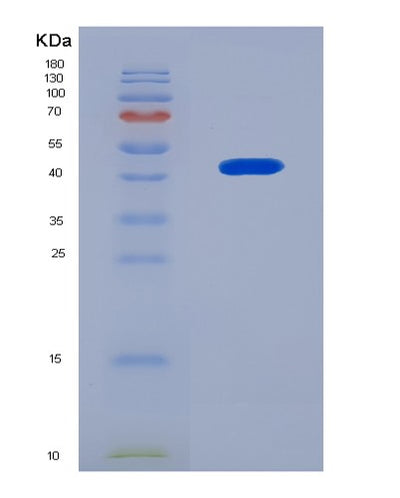 SDS-PAGE analysis of Human BRAF (Serine/Threonine-Protein Kinase B-Raf) - Recombinant Protein, CAT# BLT-08213P, showing >90% purity under 15% SDS-PAGE (Reduced)Human BRAF (Serine/Threonine-Protein Kinase B-Raf) - Recombinant Protein