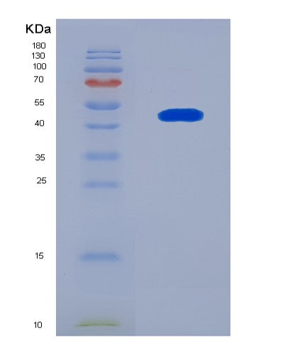 SDS-PAGE analysis of Human BRAF (Serine/Threonine-Protein Kinase B-Raf) - Recombinant Protein, CATHuman BRAF (Serine/Threonine-Protein Kinase B-Raf) - Recombinant Protein
