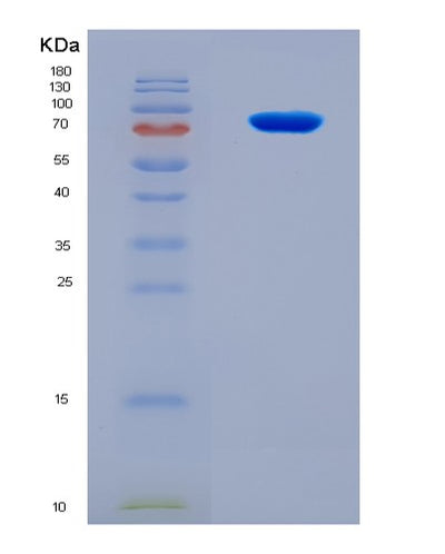 SDS-PAGE analysis of Human CHM (Rab Proteins Geranylgeranyltransferase Component A 1) - Recombinant Protein, CAT# BLT-08216P, showing >90% purity under 15% SDS-PAGE (Reduced)Human CHM (Rab Proteins Geranylgeranyltransferase Component A 1) - Recombinant Protein