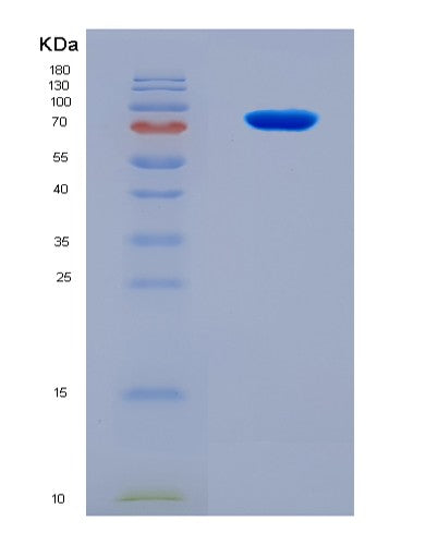 SDS-PAGE analysis of Human CHM (Rab Proteins Geranylgeranyltransferase Component A 1) - Recombinant Protein, CATHuman CHM (Rab Proteins Geranylgeranyltransferase Component A 1) - Recombinant Protein