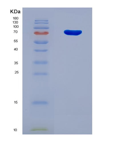 SDS-PAGE analysis of Human RABGGTA (Geranylgeranyl Transferase Type-2 Subunit Alpha) - Recombinant Protein, CAT# BLT-08217P, showing >90% purity under 15% SDS-PAGE (Reduced)Human RABGGTA (Geranylgeranyl Transferase Type-2 Subunit Alpha) - Recombinant Protein