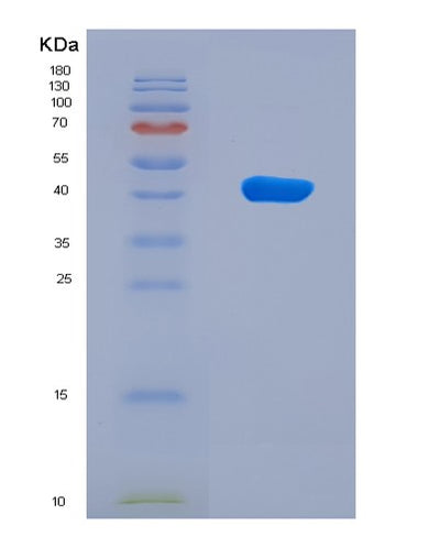 SDS-PAGE analysis of Human GSDMA (Gasdermin-A) - Recombinant Protein, CAT# BLT-08219P, showing >90% purity under 15% SDS-PAGE (Reduced)Human GSDMA (Gasdermin-A) - Recombinant Protein