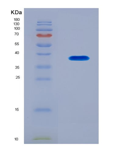 SDS-PAGE analysis of Human KRT19 (Keratin, Type I Cytoskeletal 19) - Recombinant Protein, CAT# BLT-08222P, showing >90% purity under 15% SDS-PAGE (Reduced)Human KRT19 (Keratin, Type I Cytoskeletal 19) - Recombinant Protein