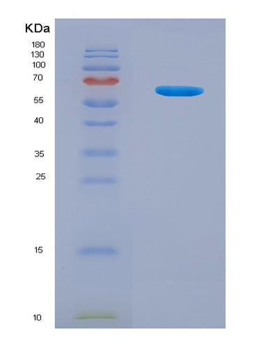 SDS-PAGE analysis of Human KRT18 (Keratin, Type I Cytoskeletal 18) - Recombinant Protein, CAT# BLT-08223P, showing >90% purity under 15% SDS-PAGE (Reduced)Human KRT18 (Keratin, Type I Cytoskeletal 18) - Recombinant Protein