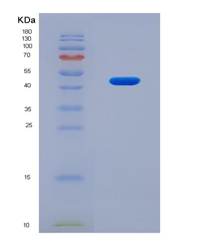SDS-PAGE analysis of Human TNFAIP6 (Tumor Necrosis Factor-Inducible Gene 6 Protein) - Recombinant Protein, CATHuman TNFAIP6 (Tumor Necrosis Factor-Inducible Gene 6 Protein) - Recombinant Protein