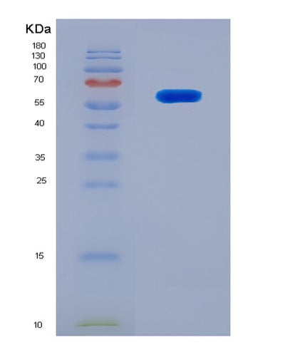 SDS-PAGE analysis of Mouse Nrbf2 (Nuclear Receptor-Binding Factor 2) - Recombinant Protein, CAT# BLT-08226P, showing >90% purity under 15% SDS-PAGE (Reduced)Mouse Nrbf2 (Nuclear Receptor-Binding Factor 2) - Recombinant Protein