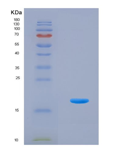 SDS-PAGE analysis of Human FGF2 (Fibroblast Growth Factor 2) - Recombinant Protein, CAT# BLT-08227P, showing >90% purity under 15% SDS-PAGE (Reduced)Human FGF2 (Fibroblast Growth Factor 2) - Recombinant Protein