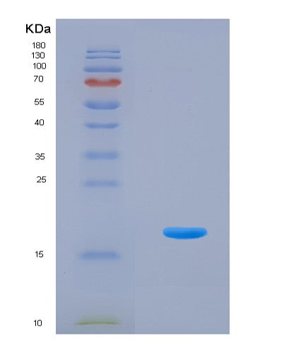 SDS-PAGE analysis of Human FGF2 (Fibroblast Growth Factor 2) - Recombinant Protein, CATHuman FGF2 (Fibroblast Growth Factor 2) - Recombinant Protein