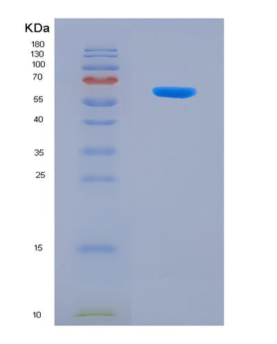 SDS-PAGE analysis of Mouse Nptx2 (Neuronal Pentraxin-2) - Recombinant Protein, CAT# BLT-08231P, showing >90% purity under 15% SDS-PAGE (Reduced)Mouse Nptx2 (Neuronal Pentraxin-2) - Recombinant Protein