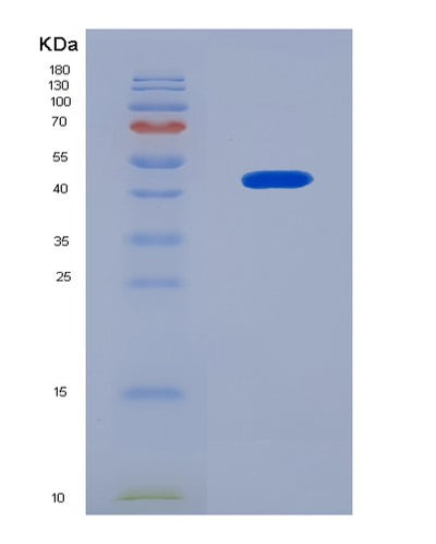 SDS-PAGE analysis of Mouse Lcn2 (Neutrophil Gelatinase-Associated Lipocalin) - Recombinant Protein, CAT# BLT-08232P, showing >90% purity under 15% SDS-PAGE (Reduced)Mouse Lcn2 (Neutrophil Gelatinase-Associated Lipocalin) - Recombinant Protein
