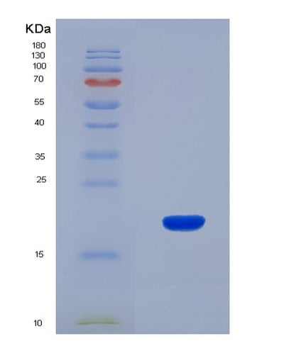 SDS-PAGE analysis of Human GDF9 (Growth/Differentiation Factor 9) - Recombinant Protein, CAT# BLT-08235P, showing >90% purity under 15% SDS-PAGE (Reduced)Human GDF9 (Growth/Differentiation Factor 9) - Recombinant Protein