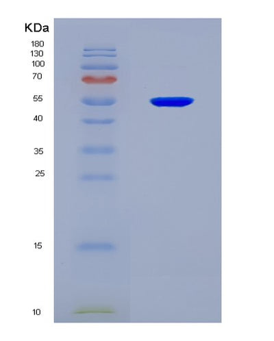 SDS-PAGE analysis of Mouse Idh2 (Isocitrate Dehydrogenase [Nadp], Mitochondrial) - Recombinant Protein, CAT# BLT-08239P, showing >90% purity under 15% SDS-PAGE (Reduced)Mouse Idh2 (Isocitrate Dehydrogenase [Nadp], Mitochondrial) - Recombinant Protein