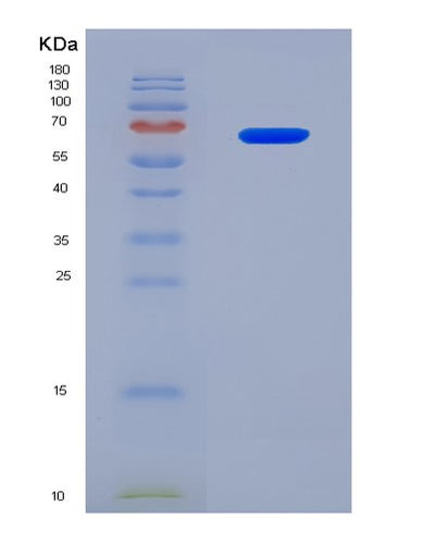 SDS-PAGE analysis of Human HSPD1 (60 Kda Heat Shock Protein, Mitochondrial) - Recombinant Protein, CAT# BLT-08242P, showing >90% purity under 15% SDS-PAGE (Reduced)Human HSPD1 (60 Kda Heat Shock Protein, Mitochondrial) - Recombinant Protein