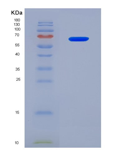 SDS-PAGE analysis of Human HSPD1 (60 Kda Heat Shock Protein, Mitochondrial) - Recombinant Protein, CATHuman HSPD1 (60 Kda Heat Shock Protein, Mitochondrial) - Recombinant Protein